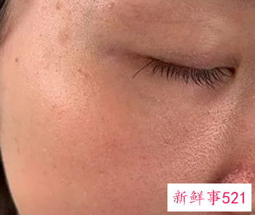 皮肤暗黄没有光泽是什么原因