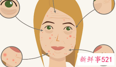 白醋怎么洗脸祛斑