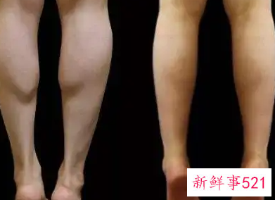瘦腿的科学方法是什么
