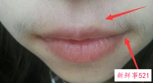 嘴唇上面胡子怎么处理比较好