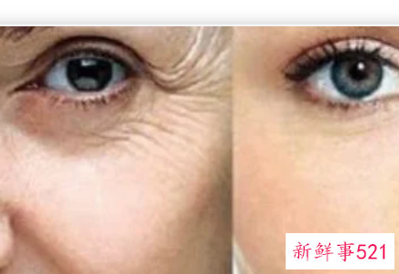 国内最好的除皱方法