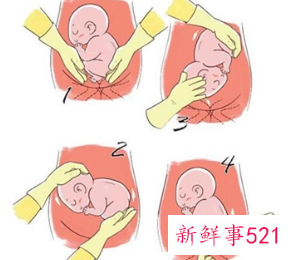 7个月胎位不正怎么办