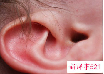 油耳屎怎么清理最好方法