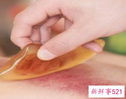 怎么刮痧才是正确的