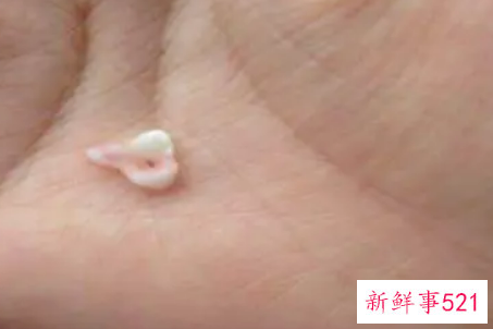 梦见下面的牙齿掉了