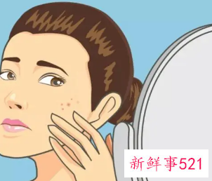 水油平衡是不是就不长痘痘