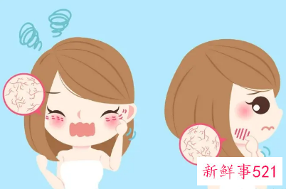 干燥肌肤应对对策有哪些