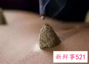 艾灸肚脐减肥的方法