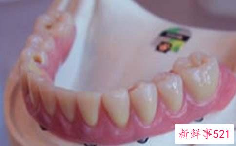 牙龈肿了一般几天消肿