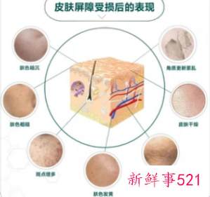 皮肤屏障受损症状