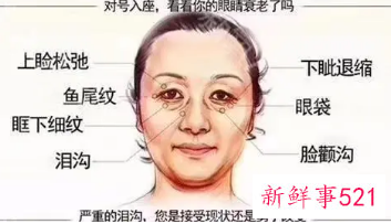眼睛衰老的表现