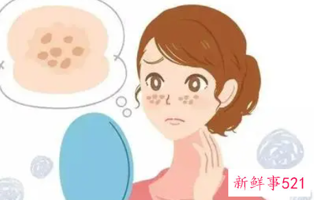 点斑留下的黑印多久才能恢复