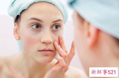 去除眼袋好方法有哪些