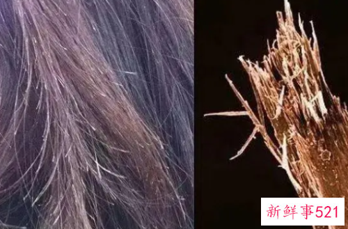 头发分叉能养回来吗