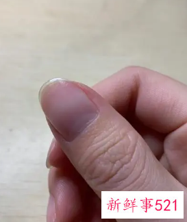 延长甲会不会不舒服