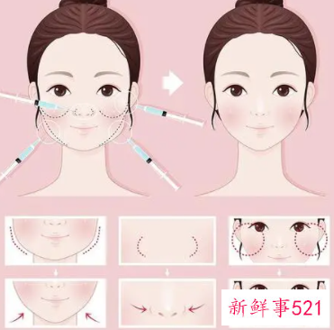 医美最安全的除皱方法是什么