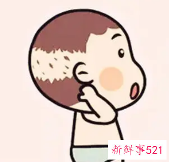 婴儿枕秃多久恢复正常