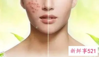 皮肤耐受性差怎么修复