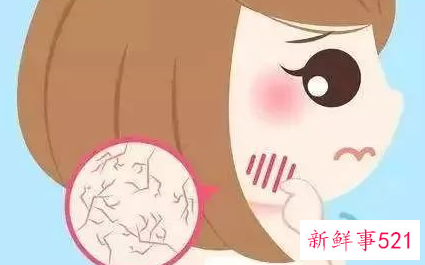 改善皮肤的方法有哪些