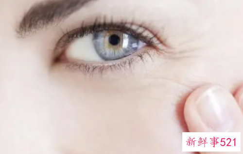 眼睛有皱纹如何消除