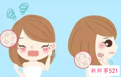 冬季的护肤小知识