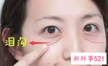 去泪沟最好的方法有哪些