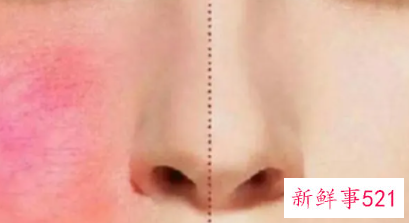 皮肤耐受性差怎么修复