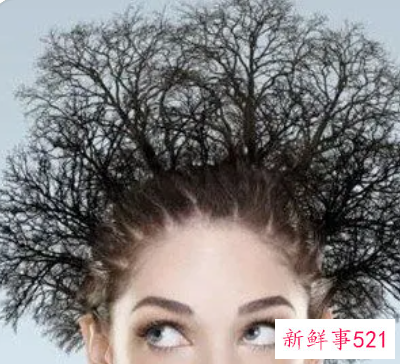 头发分叉能养回来吗