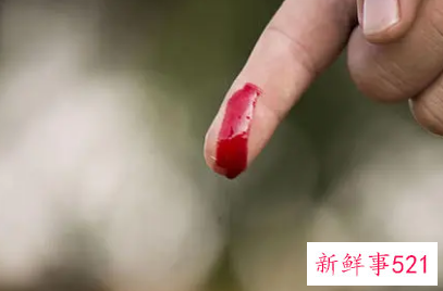 梦见流血出血什么寓意