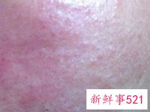 为什么化妆过后脸会痒