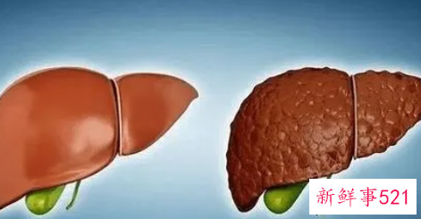 吃什么可以降脂肪肝