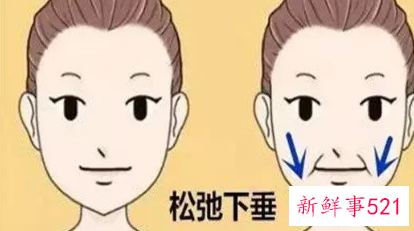 怎么改善面部松弛下垂