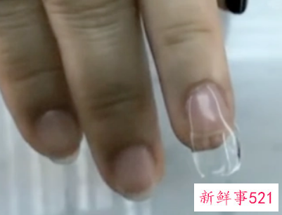 延长甲会不会不舒服