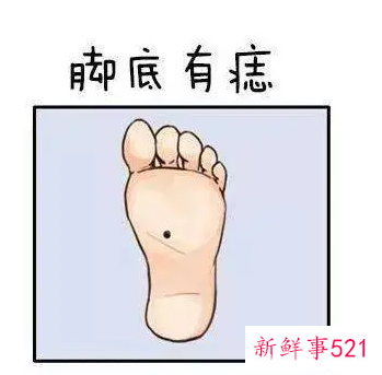危险的痣有什么特点