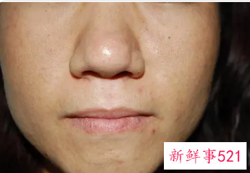 男皮肤暗沉粗糙怎么办