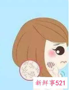 如何修复脸部泛红