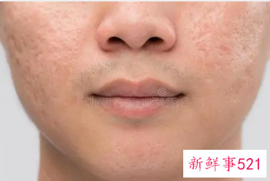 男皮肤暗沉粗糙怎么办