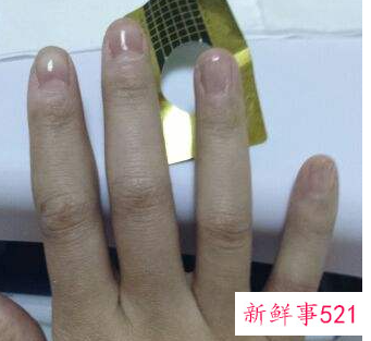 做了延长甲要注意什么