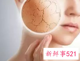 皮肤里像针扎有刺痛感