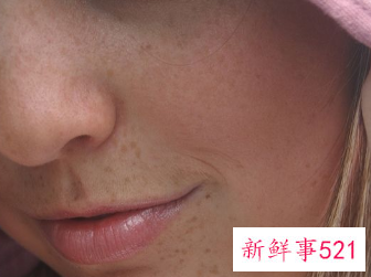 男皮肤暗沉粗糙怎么办