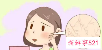 如何判断皮肤是否缺水