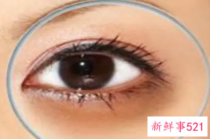 怎么才能快速消除黑眼圈