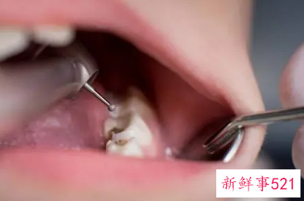 营养牙床少蛀虫