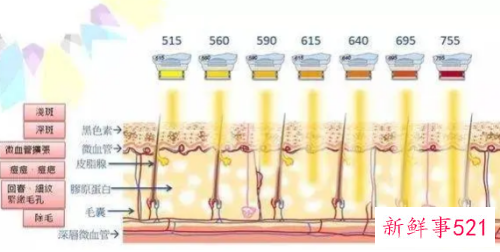 光子嫩肤能美白吗