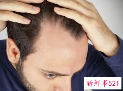 男士应该重点保养的部位有哪些