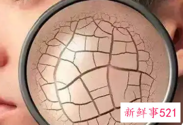 如何判断皮肤是否缺水