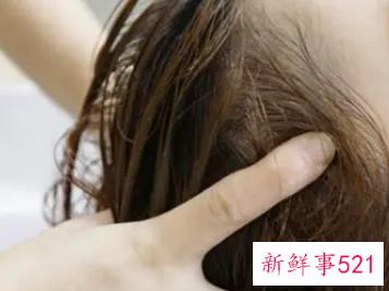 男性脱发原因大盘点