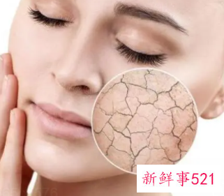 脸部皮肤干燥是怎么回事