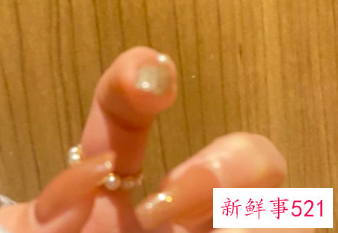 做了延长甲要注意什么