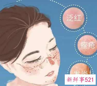 如何修复脸部泛红